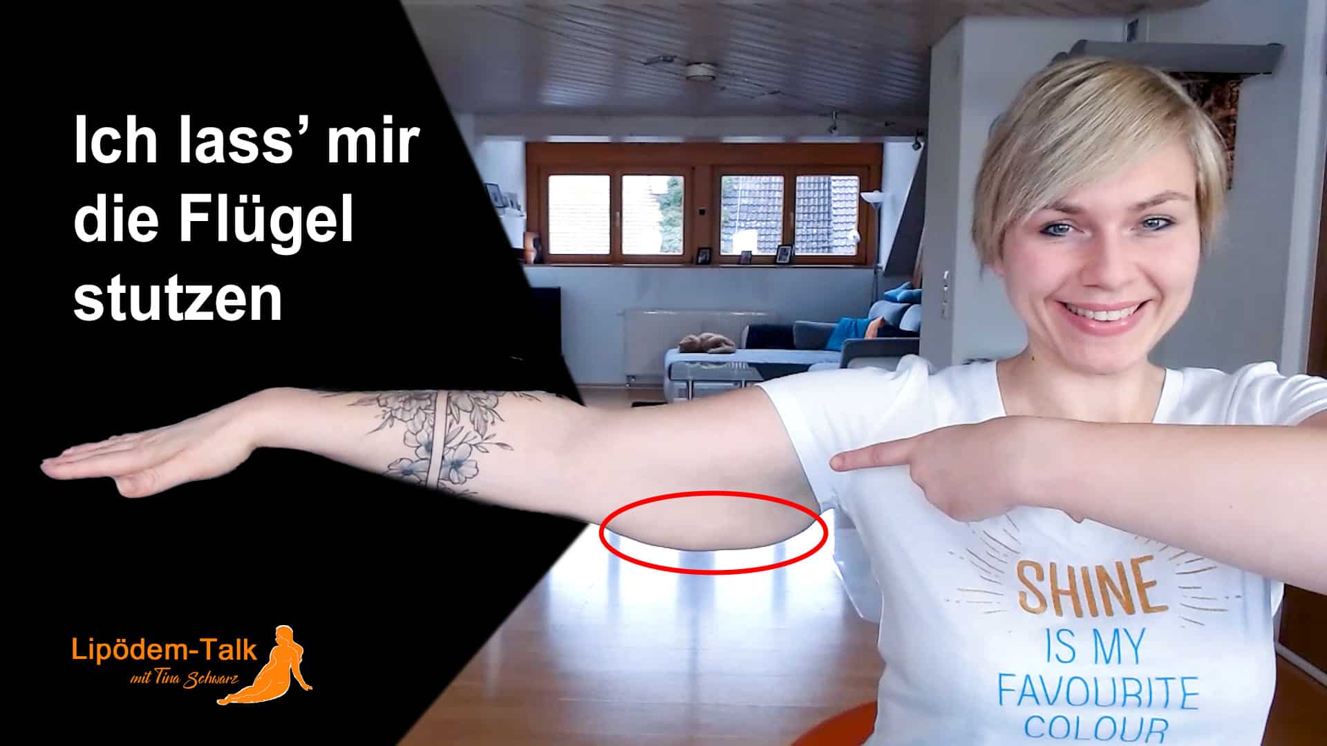 "Ich lass’ mir die Flügel stutzen“ - Meine Liposuktion an den Armen inkl. Hautstraffung