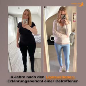 Angst und Hoffnung - Mandys Weg durch die Liposuktionen