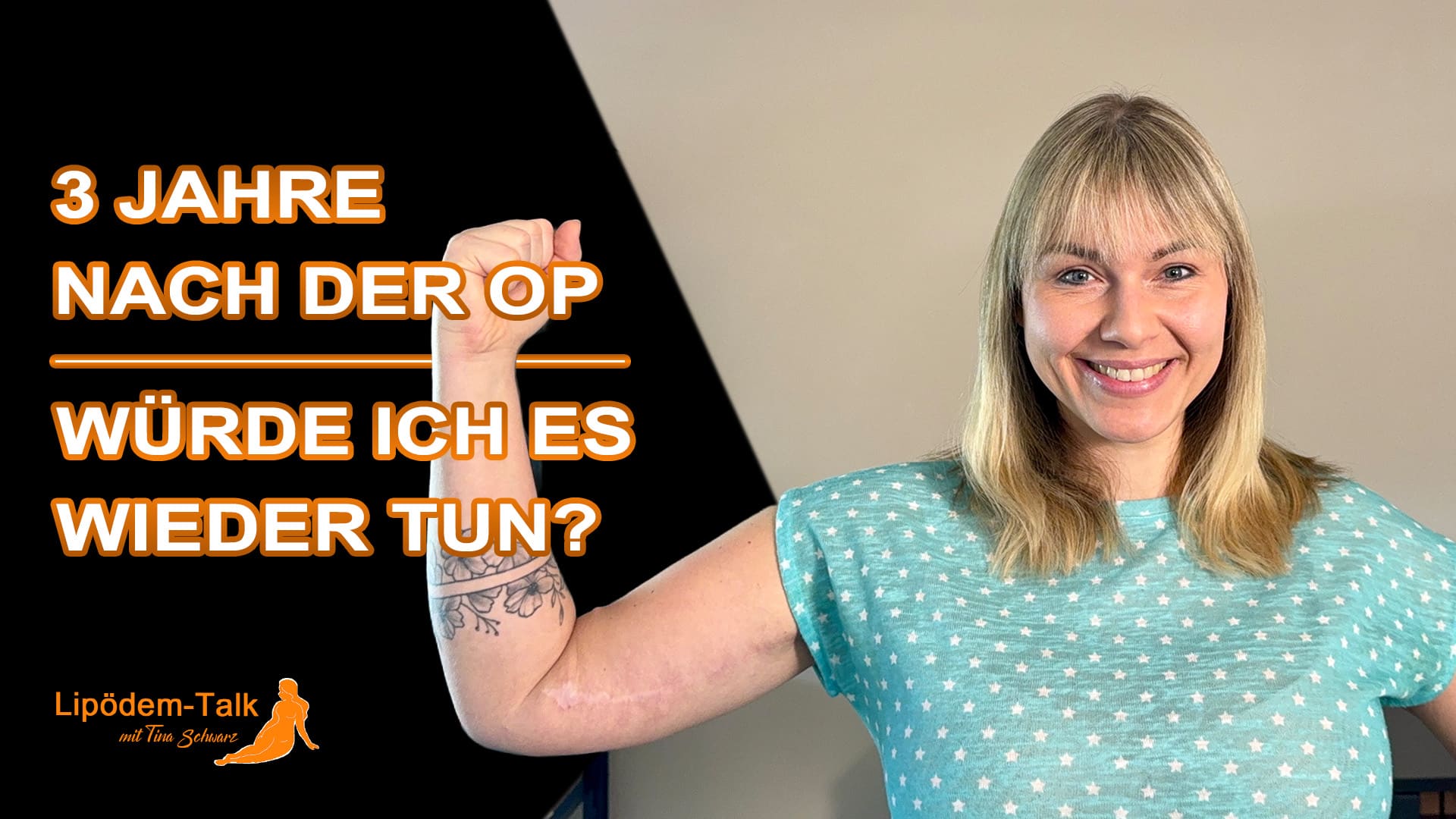 Lipödem an den Armen - Vorher-Nachher