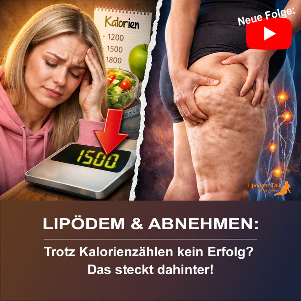 Lipödem & Abnehmen - Trotz Kalorienzählen kein Erfolg