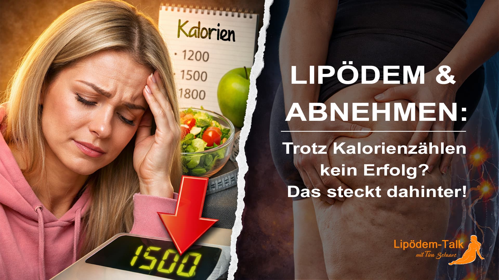 Lipödem & Abnehmen - Trotz Kalorienzählen kein Erfolg