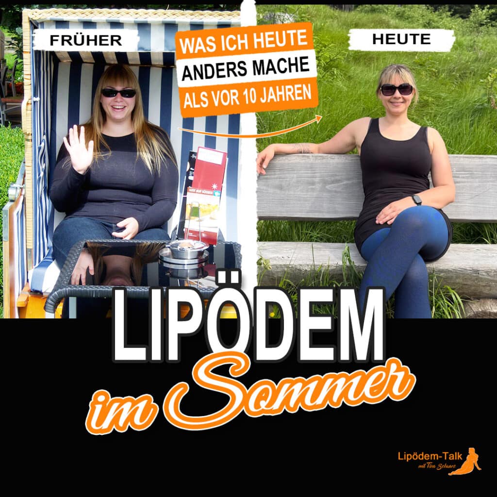 Lipödem im Sommer - Was ich heute anders mache als vor 10 Jahren